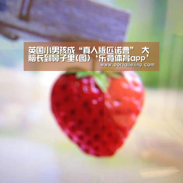英国小男孩成“真人版匹诺曹” 大脑长到鼻子里(图)‘乐竟体育app’(图2) 乐竟体育平台